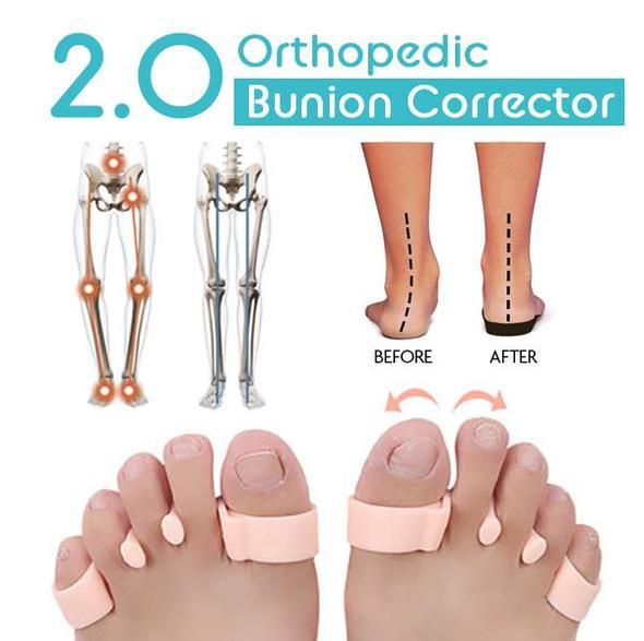 Toe correction